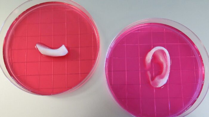 “3D biyo-baskılı” kulak için tüm çalışmalar başladı