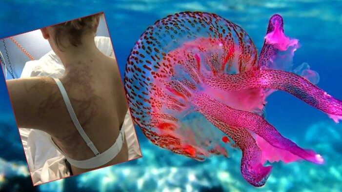 Zehirli deniz anaları paniğe yol açtı