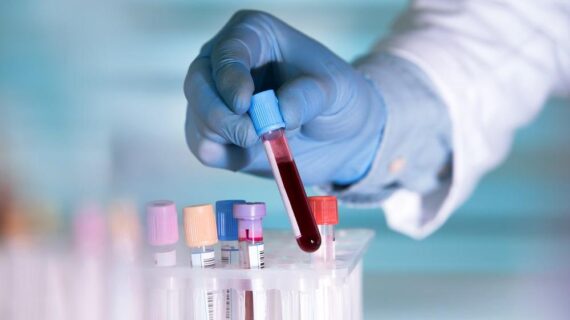 COVID-19’u tespit eden kan testi geliştiriliyor