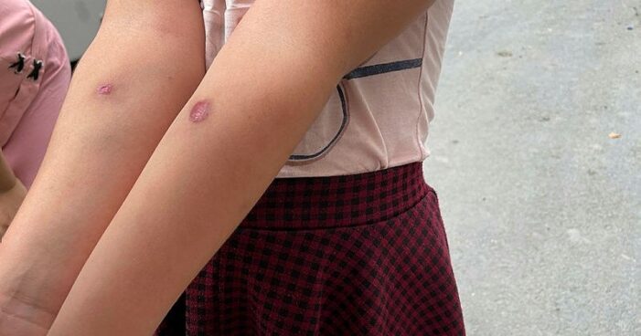 “Asya Kaplan Sivrisineği” endişe yaratıyor