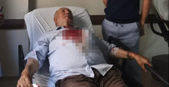 Camideki kavgayı ayırmak isteyen imamı yumrukladı