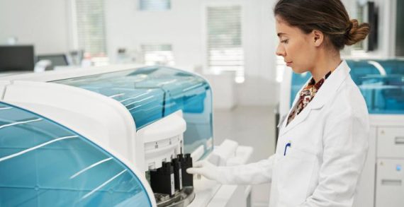 Alzheimer Teşhisinde Devrim
