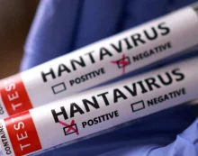 ABD, Hantavirüs vakalarını “3. seviye acil durum” koduyla takibe aldı.. ABD, Hantavirüs vakalarını “3. seviye acil durum” koduyla takibe aldı..